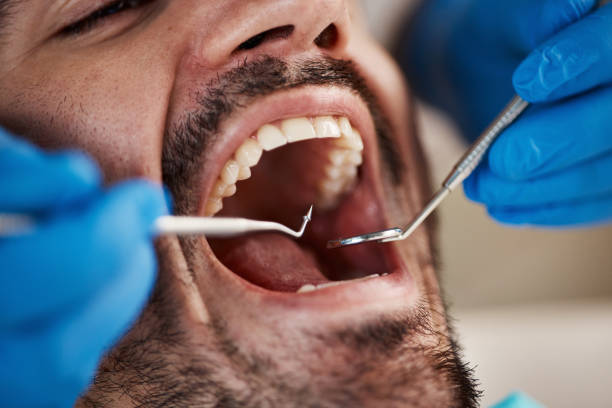 Best Pediatric Emergency Dentist in Lake Grove, NY